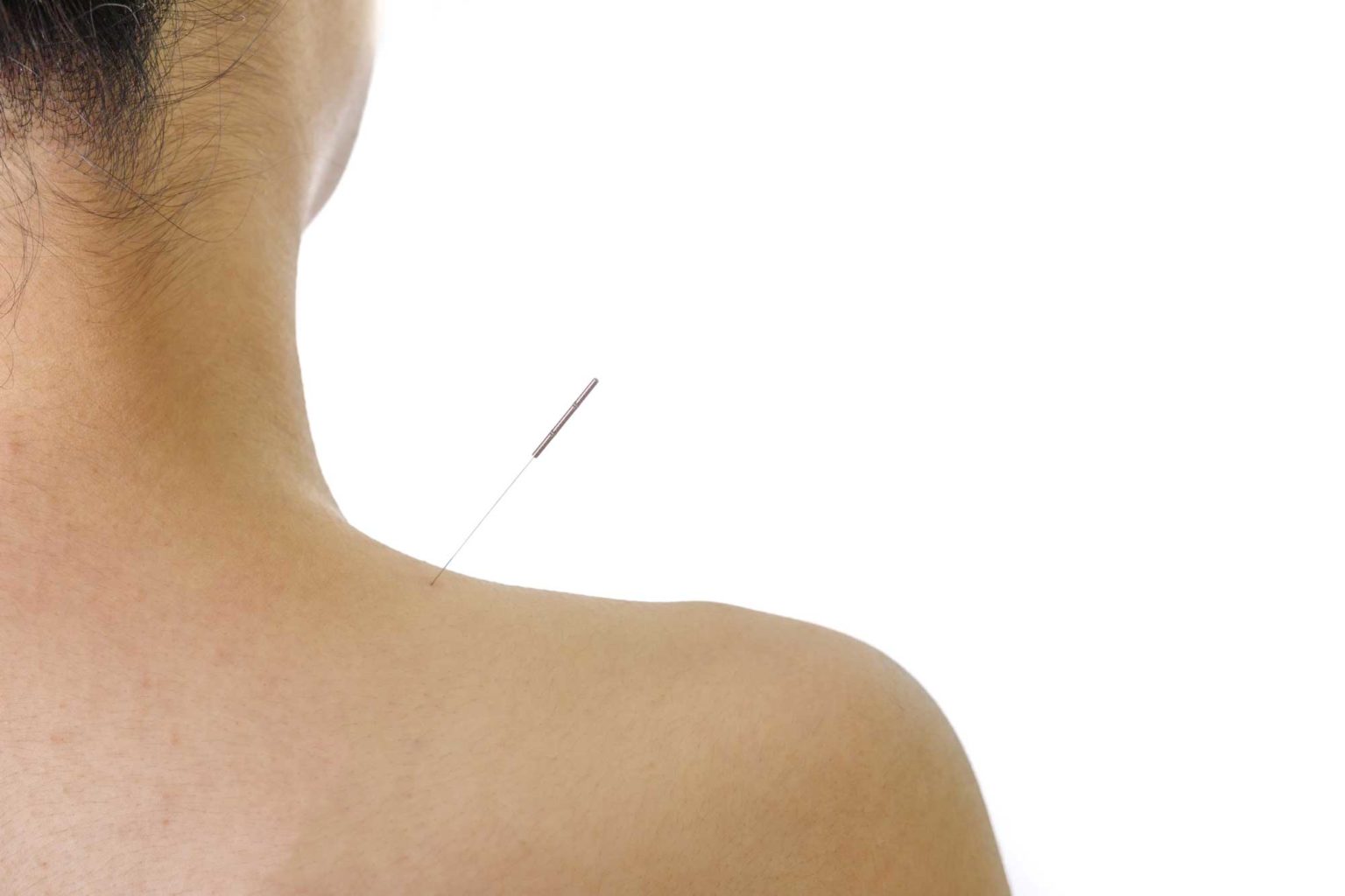 Acupuncture Sages Femmes Le Touvet, Isère (38)